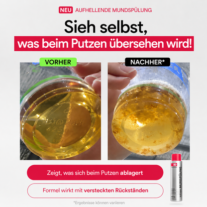 Mundspülung — 2er Set